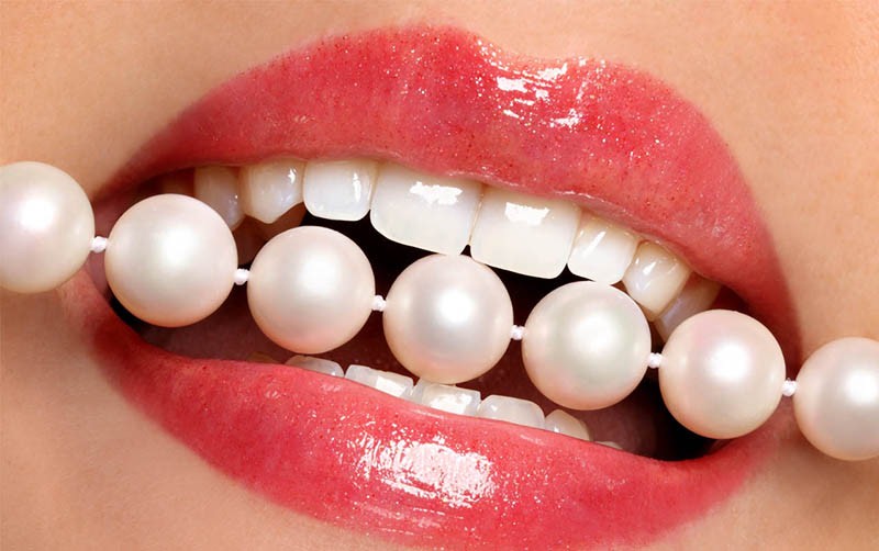 Diş implantları