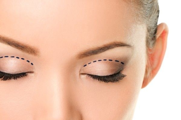 Kaş implantları
